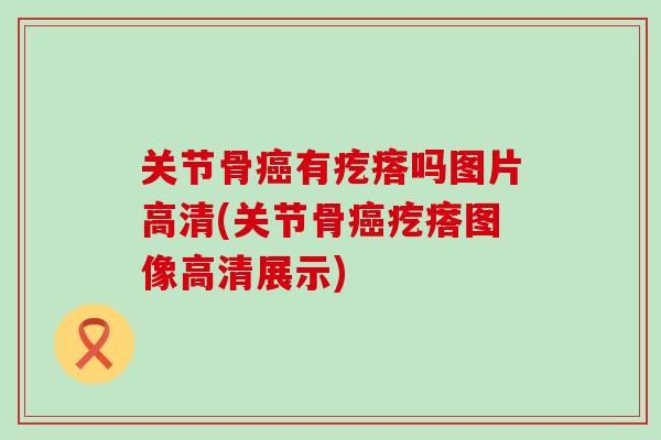 关节骨癌有疙瘩吗图片高清(关节骨癌疙瘩图像高清展示)-第1张图片-氨糖科普网 关节骨癌有疙瘩吗图片高清(关节骨癌疙瘩图像高清展示)-第1张图片-氨糖科普网