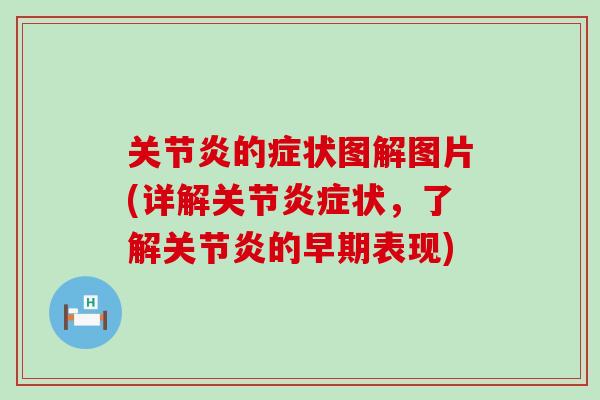 关节炎的症状图解图片(详解关节炎症状,了解关节炎的早期表现)-第1张图片-氨糖科普网 关节炎的症状图解图片(详解关节炎症状,了解关节炎的早期表现)-第1张图片-氨糖科普网