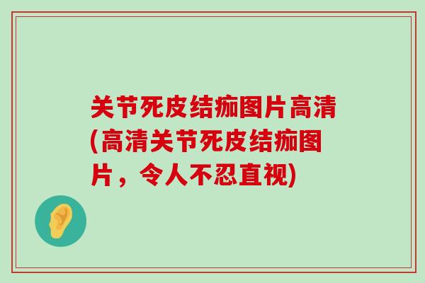 关节死皮结痂图片高清(高清关节死皮结痂图片,令人不忍直视)-第1张图片-氨糖科普网 关节死皮结痂图片高清(高清关节死皮结痂图片,令人不忍直视)-第1张图片-氨糖科普网