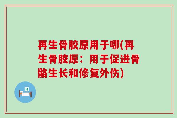 再生骨胶原用于哪(再生骨胶原:用于促进骨骼生长和修复外伤)-第1张图片-氨糖科普网 再生骨胶原用于哪(再生骨胶原:用于促进骨骼生长和修复外伤)-第1张图片-氨糖科普网