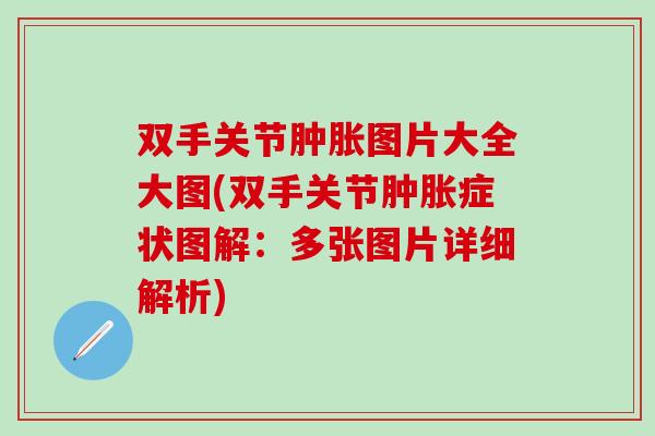双手关节肿胀图片大全大图(双手关节肿胀症状图解：多张图片详细解析)-第1张图片-氨糖科普网