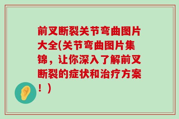前叉断裂关节弯曲图片大全(关节弯曲图片集锦,让你深入了解前叉断裂的症状和治疗方案!)-第1张图片-氨糖科普网 前叉断裂关节弯曲图片大全(关节弯曲图片集锦,让你深入了解前叉断裂的症状和治疗方案!)-第1张图片-氨糖科普网