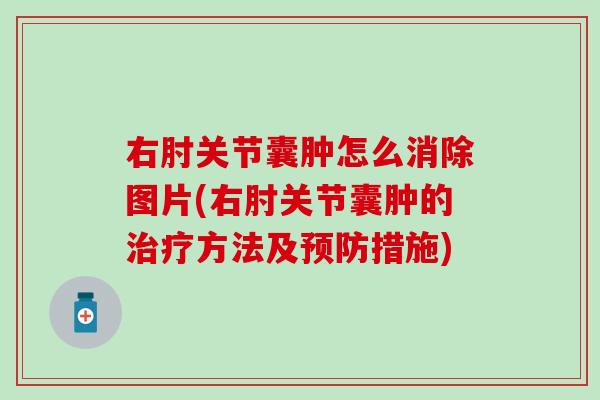 右肘关节囊肿怎么消除图片(右肘关节囊肿的治疗方法及预防措施)-第1张图片-氨糖科普网 右肘关节囊肿怎么消除图片(右肘关节囊肿的治疗方法及预防措施)-第1张图片-氨糖科普网