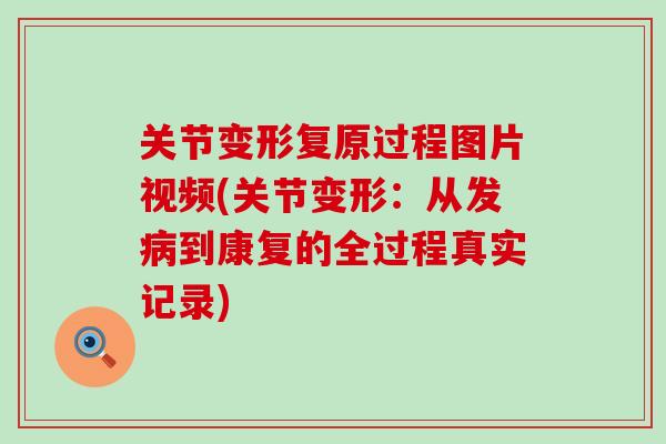 关节变形复原过程图片视频(关节变形:从发病到康复的全过程真实记录)-第1张图片-氨糖科普网 关节变形复原过程图片视频(关节变形:从发病到康复的全过程真实记录)-第1张图片-氨糖科普网