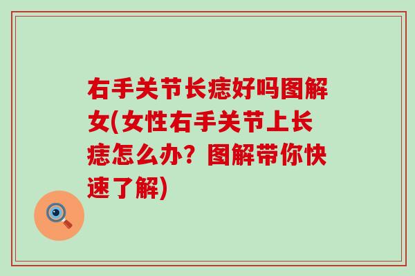 右手关节长痣好吗图解女(女性右手关节上长痣怎么办?图解带你快速了解)-第1张图片-氨糖科普网 右手关节长痣好吗图解女(女性右手关节上长痣怎么办?图解带你快速了解)-第1张图片-氨糖科普网