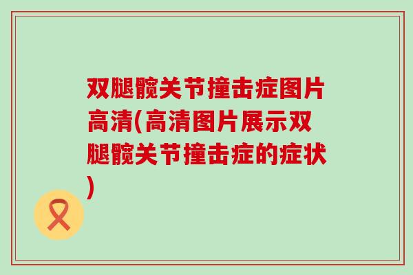 双腿髋关节撞击症图片高清(高清图片展示双腿髋关节撞击症的症状)-第1张图片-氨糖科普网 双腿髋关节撞击症图片高清(高清图片展示双腿髋关节撞击症的症状)-第1张图片-氨糖科普网