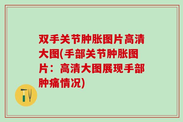双手关节肿胀图片高清大图(手部关节肿胀图片:高清大图展现手部肿痛情况)-第1张图片-氨糖科普网 双手关节肿胀图片高清大图(手部关节肿胀图片:高清大图展现手部肿痛情况)-第1张图片-氨糖科普网