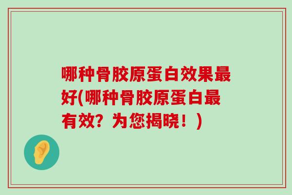 哪种骨胶原蛋白效果最好(哪种骨胶原蛋白最有效？为您揭晓！)-第1张图片-氨糖科普网