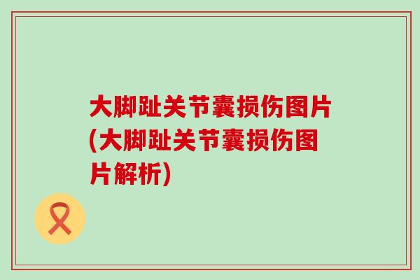 大脚趾关节囊损伤图片(大脚趾关节囊损伤图片解析)-第1张图片-氨糖科普网 大脚趾关节囊损伤图片(大脚趾关节囊损伤图片解析)-第1张图片-氨糖科普网