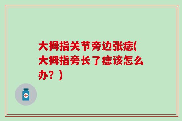 大拇指关节旁边张痣(大拇指旁长了痣该怎么办?)-第1张图片-氨糖科普网 大拇指关节旁边张痣(大拇指旁长了痣该怎么办?)-第1张图片-氨糖科普网