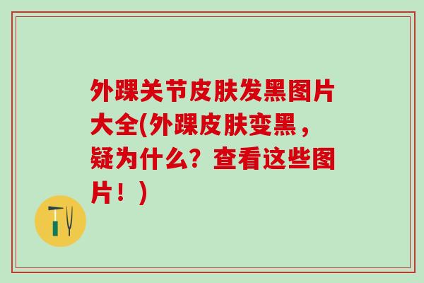 外踝关节皮肤发黑图片大全(外踝皮肤变黑,疑为什么?查看这些图片!)-第1张图片-氨糖科普网 外踝关节皮肤发黑图片大全(外踝皮肤变黑,疑为什么?查看这些图片!)-第1张图片-氨糖科普网