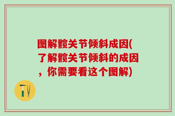 图解髋关节倾斜成因(了解髋关节倾斜的成因,你需要看这个图解)-第1张图片-氨糖科普网 图解髋关节倾斜成因(了解髋关节倾斜的成因,你需要看这个图解)-第1张图片-氨糖科普网