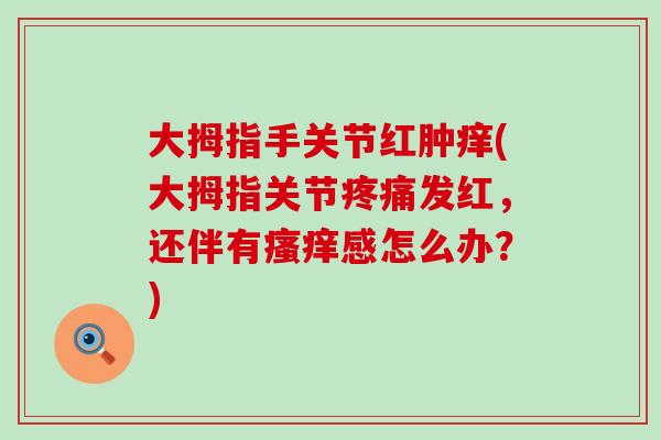 大拇指手关节红肿痒(大拇指关节疼痛发红,还伴有瘙痒感怎么办?)-第1张图片-氨糖科普网 大拇指手关节红肿痒(大拇指关节疼痛发红,还伴有瘙痒感怎么办?)-第1张图片-氨糖科普网