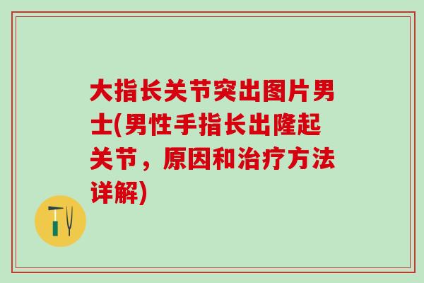 大指长关节突出图片男士(男性手指长出隆起关节,原因和治疗方法详解)-第1张图片-氨糖科普网 大指长关节突出图片男士(男性手指长出隆起关节,原因和治疗方法详解)-第1张图片-氨糖科普网