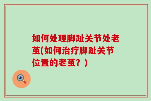 如何处理脚趾关节处老茧(如何治疗脚趾关节位置的老茧?)-第1张图片-氨糖科普网 如何处理脚趾关节处老茧(如何治疗脚趾关节位置的老茧?)-第1张图片-氨糖科普网