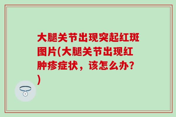 大腿关节出现突起红斑图片(大腿关节出现红肿疹症状，该怎么办？)-第1张图片-氨糖科普网