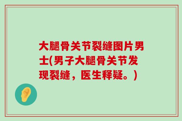 大腿骨关节裂缝图片男士(男子大腿骨关节发现裂缝，医生释疑。)-第1张图片-氨糖科普网