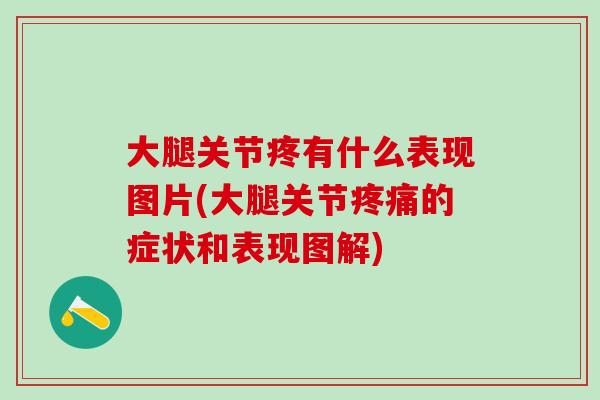 大腿关节疼有什么表现图片(大腿关节疼痛的症状和表现图解)-第1张图片-氨糖科普网 大腿关节疼有什么表现图片(大腿关节疼痛的症状和表现图解)-第1张图片-氨糖科普网