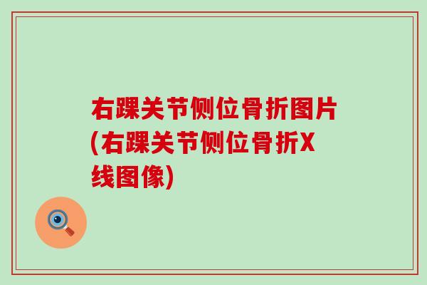右踝关节侧位骨折图片(右踝关节侧位骨折X线图像)-第1张图片-氨糖科普网 右踝关节侧位骨折图片(右踝关节侧位骨折X线图像)-第1张图片-氨糖科普网