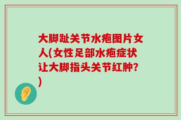 大脚趾关节水疱图片女人(女性足部水疱症状让大脚指头关节红肿?)-第1张图片-氨糖科普网 大脚趾关节水疱图片女人(女性足部水疱症状让大脚指头关节红肿?)-第1张图片-氨糖科普网