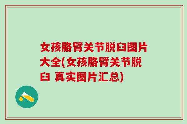 女孩胳臂关节脱臼图片大全(女孩胳臂关节脱臼 真实图片汇总)-第1张图片-氨糖科普网 女孩胳臂关节脱臼图片大全(女孩胳臂关节脱臼 真实图片汇总)-第1张图片-氨糖科普网