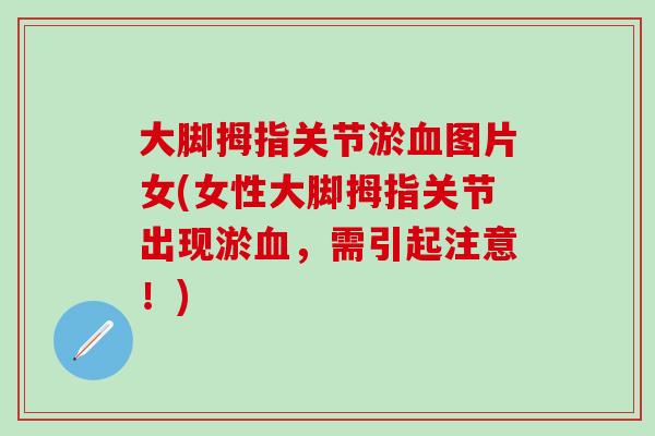 大脚拇指关节淤血图片女(女性大脚拇指关节出现淤血,需引起注意!)-第1张图片-氨糖科普网 大脚拇指关节淤血图片女(女性大脚拇指关节出现淤血,需引起注意!)-第1张图片-氨糖科普网