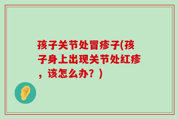 孩子关节处冒疹子(孩子身上出现关节处红疹,该怎么办?)-第1张图片-氨糖科普网 孩子关节处冒疹子(孩子身上出现关节处红疹,该怎么办?)-第1张图片-氨糖科普网