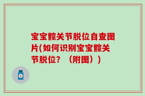 宝宝髋关节脱位自查图片(如何识别宝宝髋关节脱位?(附图))-第1张图片-氨糖科普网 宝宝髋关节脱位自查图片(如何识别宝宝髋关节脱位?(附图))-第1张图片-氨糖科普网