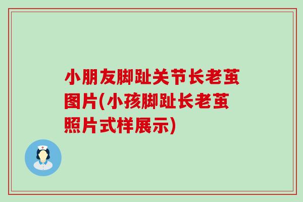 小朋友脚趾关节长老茧图片(小孩脚趾长老茧照片式样展示)-第1张图片-氨糖科普网 小朋友脚趾关节长老茧图片(小孩脚趾长老茧照片式样展示)-第1张图片-氨糖科普网