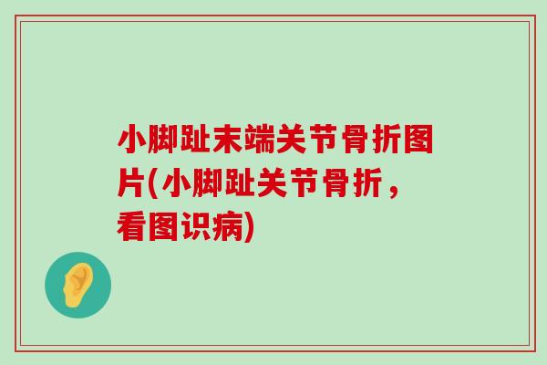 小脚趾末端关节骨折图片(小脚趾关节骨折,看图识病)-第1张图片-氨糖科普网 小脚趾末端关节骨折图片(小脚趾关节骨折,看图识病)-第1张图片-氨糖科普网