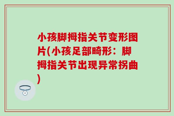 小孩脚拇指关节变形图片(小孩足部畸形:脚拇指关节出现异常拐曲)-第1张图片-氨糖科普网 小孩脚拇指关节变形图片(小孩足部畸形:脚拇指关节出现异常拐曲)-第1张图片-氨糖科普网
