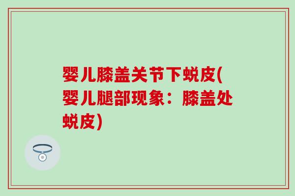 婴儿膝盖关节下蜕皮(婴儿腿部现象：膝盖处蜕皮)-第1张图片-氨糖科普网