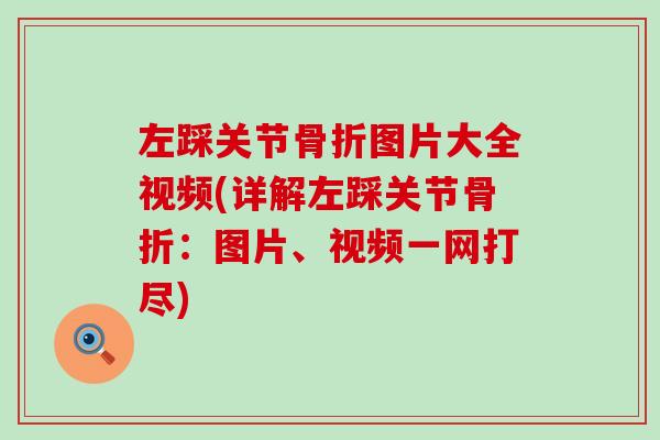 左踩关节骨折图片大全视频(详解左踩关节骨折:图片、视频一网打尽)-第1张图片-氨糖科普网 左踩关节骨折图片大全视频(详解左踩关节骨折:图片、视频一网打尽)-第1张图片-氨糖科普网