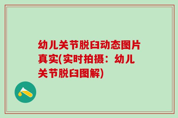 幼儿关节脱臼动态图片真实(实时拍摄:幼儿关节脱臼图解)-第1张图片-氨糖科普网 幼儿关节脱臼动态图片真实(实时拍摄:幼儿关节脱臼图解)-第1张图片-氨糖科普网