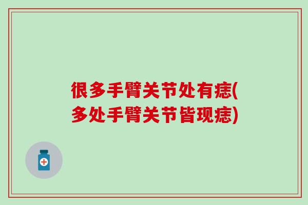 很多手臂关节处有痣(多处手臂关节皆现痣)-第1张图片-氨糖科普网 很多手臂关节处有痣(多处手臂关节皆现痣)-第1张图片-氨糖科普网