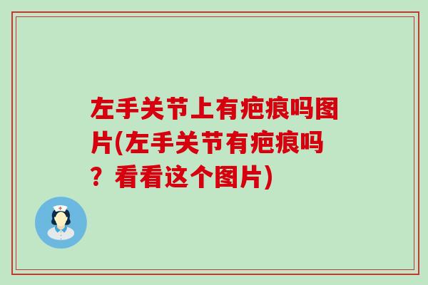 左手关节上有疤痕吗图片(左手关节有疤痕吗?看看这个图片)-第1张图片-氨糖科普网 左手关节上有疤痕吗图片(左手关节有疤痕吗?看看这个图片)-第1张图片-氨糖科普网