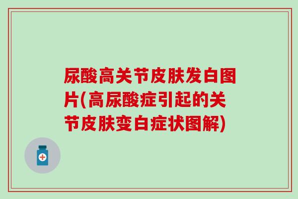 尿酸高关节皮肤发白图片(高尿酸症引起的关节皮肤变白症状图解)-第1张图片-氨糖科普网