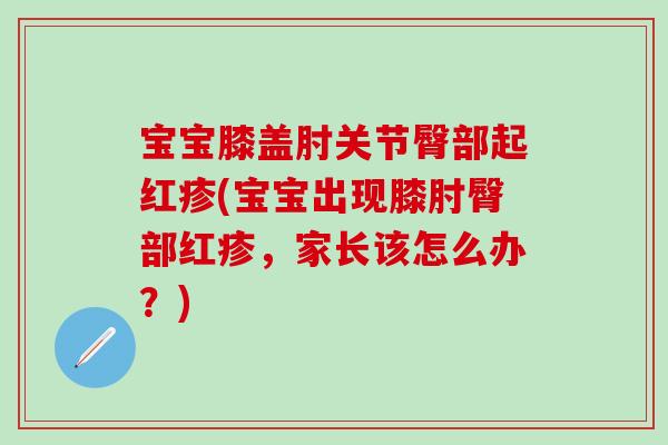 宝宝膝盖肘关节臀部起红疹(宝宝出现膝肘臀部红疹,家长该怎么办?)-第1张图片-氨糖科普网 宝宝膝盖肘关节臀部起红疹(宝宝出现膝肘臀部红疹,家长该怎么办?)-第1张图片-氨糖科普网