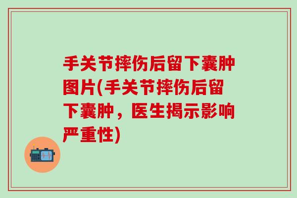 手关节摔伤后留下囊肿图片(手关节摔伤后留下囊肿,医生揭示影响严重性)-第1张图片-氨糖科普网 手关节摔伤后留下囊肿图片(手关节摔伤后留下囊肿,医生揭示影响严重性)-第1张图片-氨糖科普网
