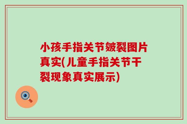 小孩手指关节皴裂图片真实(儿童手指关节干裂现象真实展示)-第1张图片-氨糖科普网