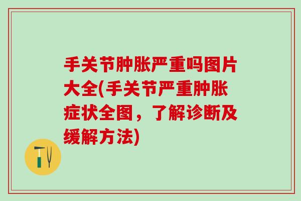 手关节肿胀严重吗图片大全(手关节严重肿胀症状全图,了解诊断及缓解方法)-第1张图片-氨糖科普网 手关节肿胀严重吗图片大全(手关节严重肿胀症状全图,了解诊断及缓解方法)-第1张图片-氨糖科普网