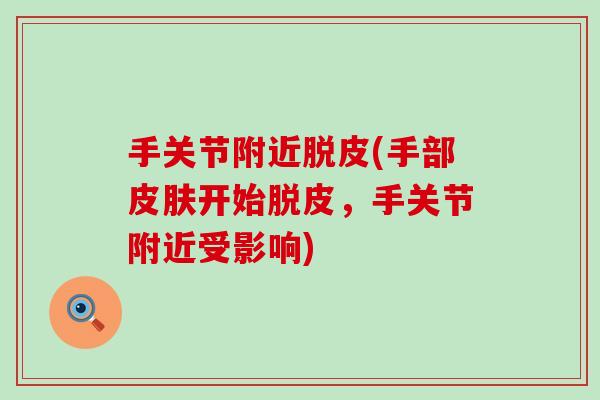 手关节附近脱皮(手部皮肤开始脱皮，手关节附近受影响)-第1张图片-氨糖科普网