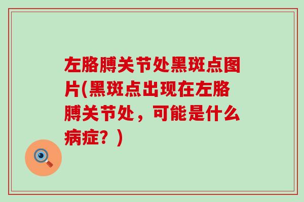 左胳膊关节处黑斑点图片(黑斑点出现在左胳膊关节处，可能是什么病症？)-第1张图片-氨糖科普网