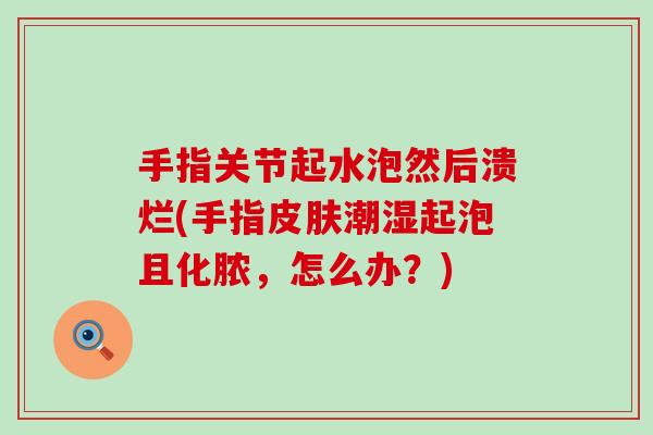 手指关节起水泡然后溃烂(手指皮肤潮湿起泡且化脓,怎么办?)-第1张图片-氨糖科普网 手指关节起水泡然后溃烂(手指皮肤潮湿起泡且化脓,怎么办?)-第1张图片-氨糖科普网