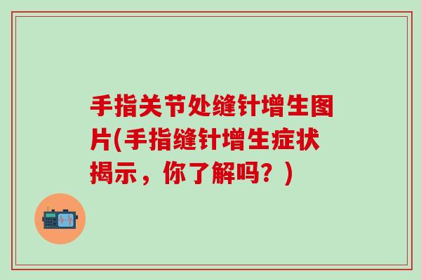 手指关节处缝针增生图片(手指缝针增生症状揭示,你了解吗?)-第1张图片-氨糖科普网 手指关节处缝针增生图片(手指缝针增生症状揭示,你了解吗?)-第1张图片-氨糖科普网