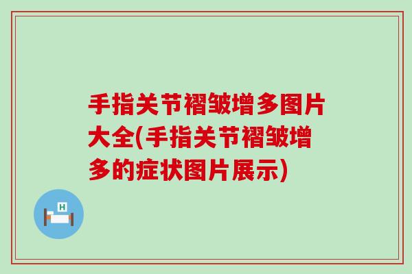 手指关节褶皱增多图片大全(手指关节褶皱增多的症状图片展示)-第1张图片-氨糖科普网 手指关节褶皱增多图片大全(手指关节褶皱增多的症状图片展示)-第1张图片-氨糖科普网