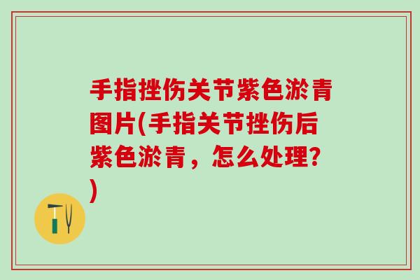 手指挫伤关节紫色淤青图片(手指关节挫伤后紫色淤青，怎么处理？)-第1张图片-氨糖科普网