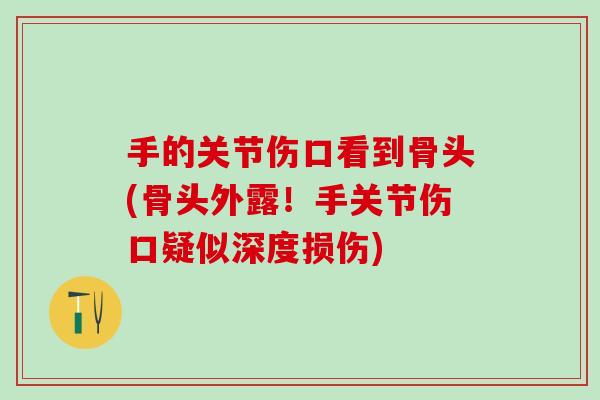 手的关节伤口看到骨头(骨头外露!手关节伤口疑似深度损伤)-第1张图片-氨糖科普网 手的关节伤口看到骨头(骨头外露!手关节伤口疑似深度损伤)-第1张图片-氨糖科普网