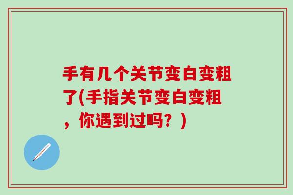 手有几个关节变白变粗了(手指关节变白变粗,你遇到过吗?)-第1张图片-氨糖科普网 手有几个关节变白变粗了(手指关节变白变粗,你遇到过吗?)-第1张图片-氨糖科普网
