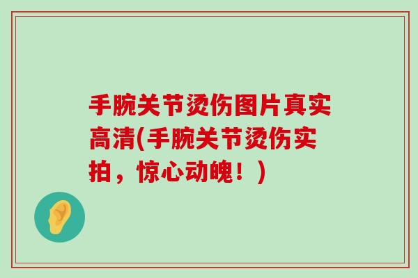 手腕关节烫伤图片真实高清(手腕关节烫伤实拍,惊心动魄!)-第1张图片-氨糖科普网 手腕关节烫伤图片真实高清(手腕关节烫伤实拍,惊心动魄!)-第1张图片-氨糖科普网